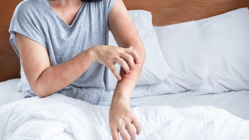 piqûre de punaise de lit sur le bras avec boutons rouges apparus au réveil